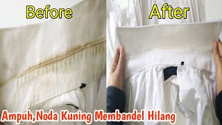 Trik Ajaib Menghilangkan Noda Kuning Di Kerah Baju Putih